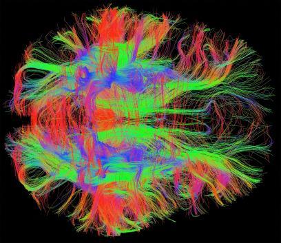 Brain synopses and electrical pathways